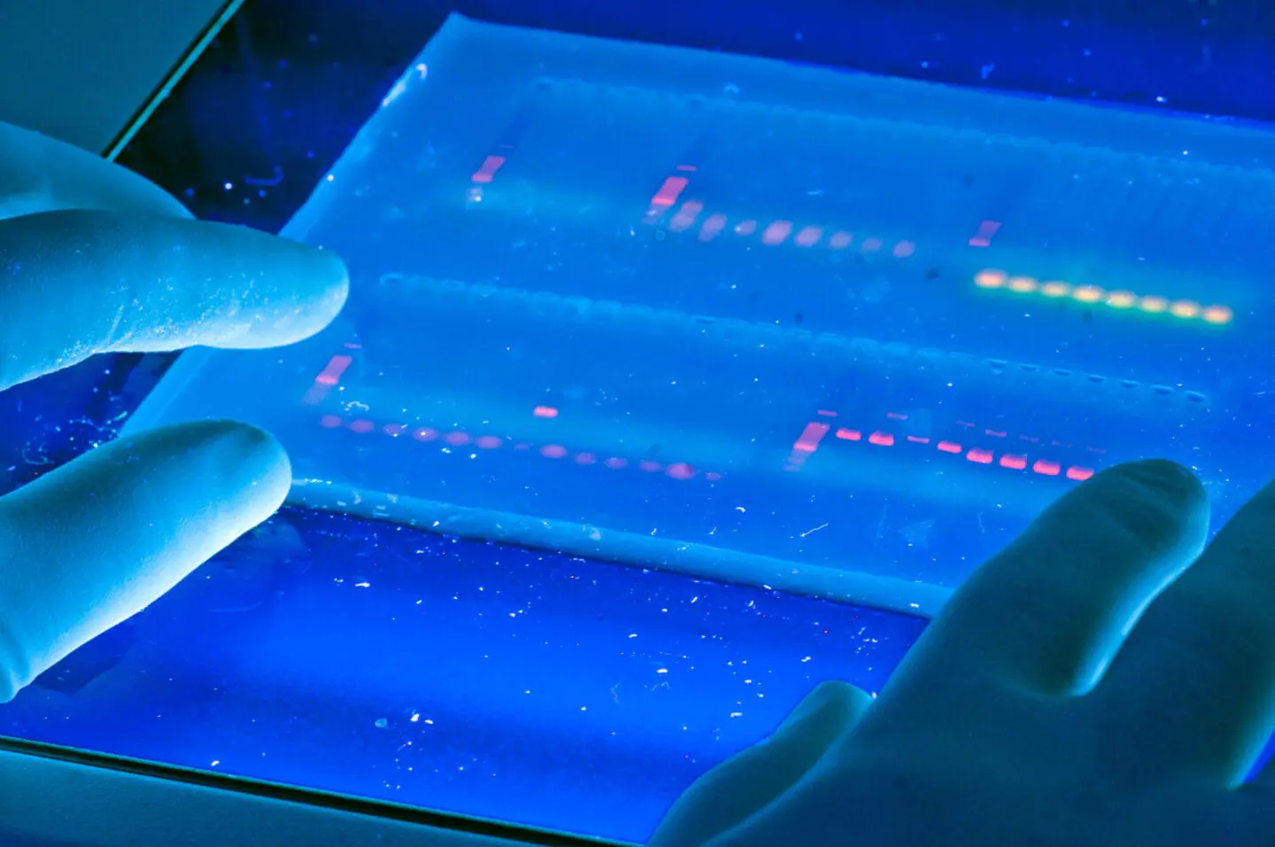 Agarose gel showing DNA bands visualized with Ethidium Bromide